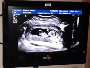 Baby stern - march 8